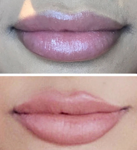 Radiant Injections