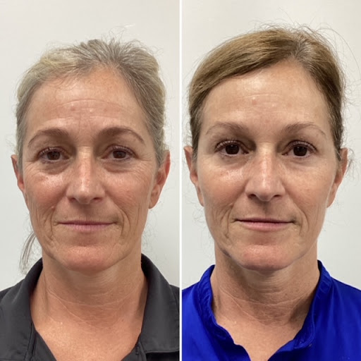 Royal Aesthetics & Injectables