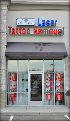 Atlantic Laser Tattoo Removal