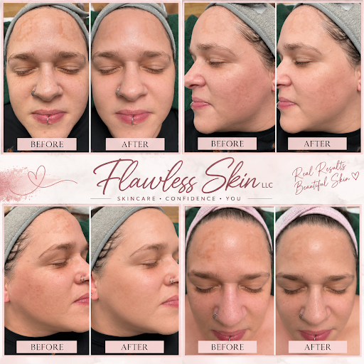 Flawless Skin LLC