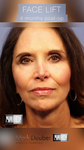 Lemmon Avenue Plastic Surgery and Laser Center