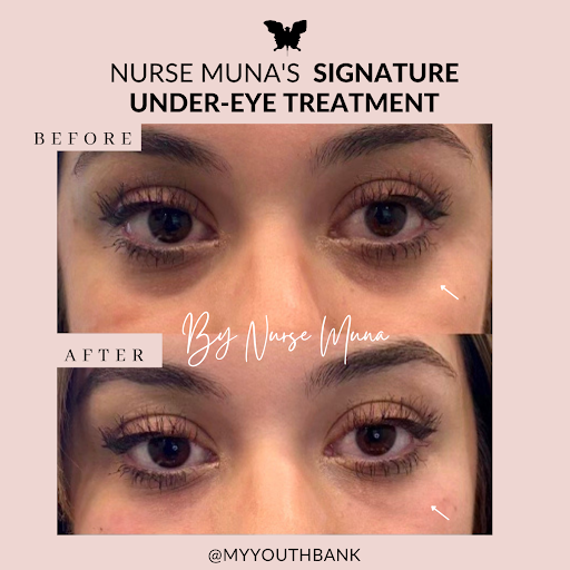 My Youth Bank Med Spa Orange County