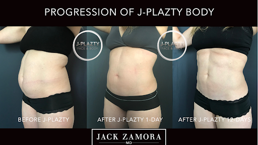 Jack Zamora MD Cosmetic Surgery and Aesthetics