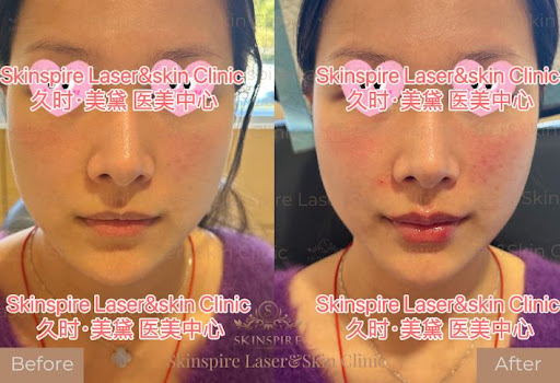 Skinspire Laser&Skin Clinic 久时美黛医美中心 – Irvine
