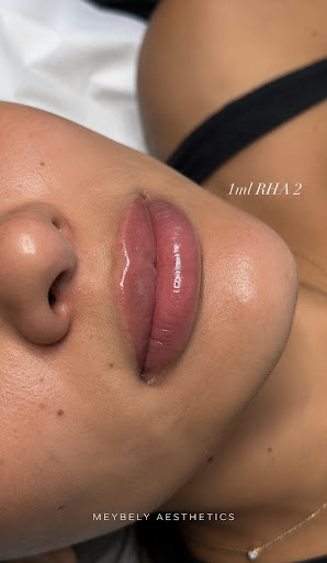Meybely Aesthetics