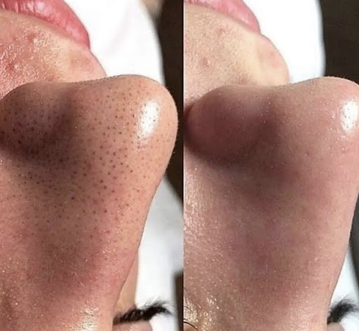 Superior Skin Aesthetics